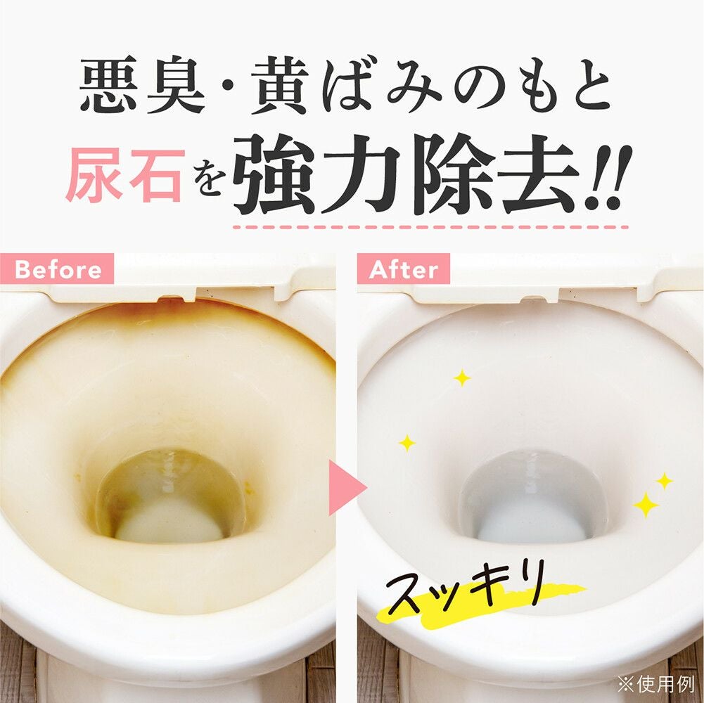  尿石取りジェル GEL PiKA（ジェルピカ）