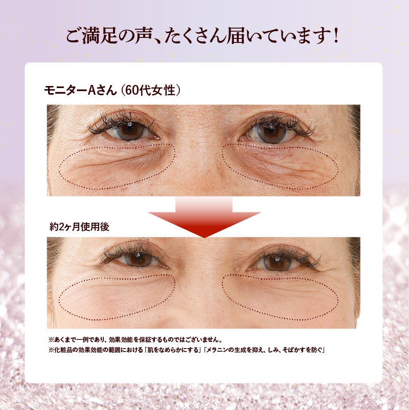 薬用アイマール